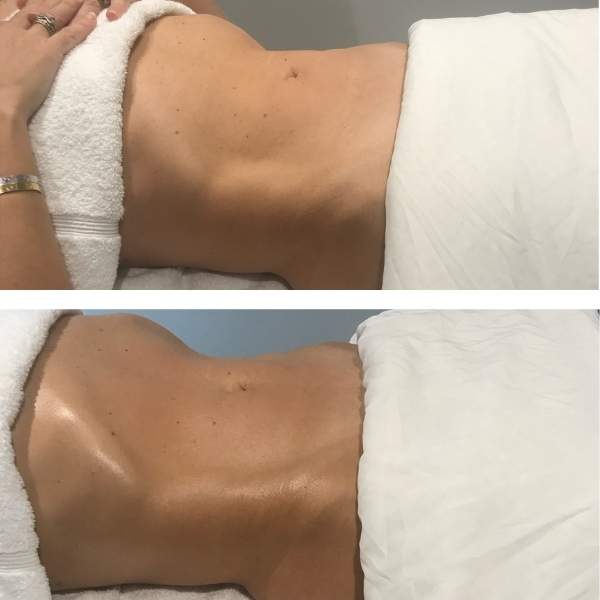 Before and after pictures of Sheila Perez method massage. The torso in the after image appears slimmer.